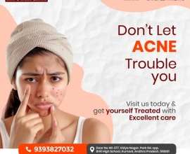facial port wine stain Treatment in india