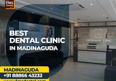 Best Dental Clinic In Madinaguda-Chandanagar  CALL Now : 08886643232