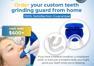 Custom Night Guard | custom teeth-grinding guard | Teeth night guard U.S