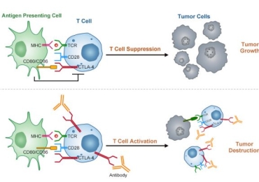 Cancer Treatment in Delhi