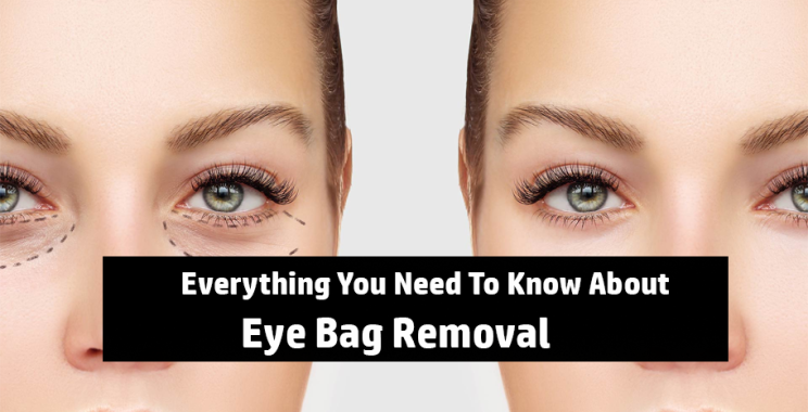 Everything You Need To Know About Eye Bag Removal