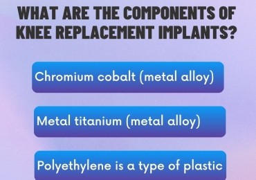 What are the components of knee replacement implants?