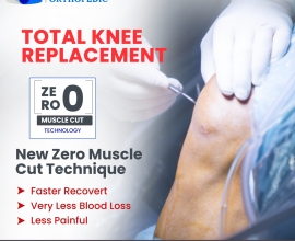 Best Orthopedic Surgeons in Kurnool at Sri Sai Satya Hospital