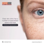 best laser treatment clinic in india