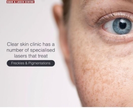 best laser treatment clinic in india