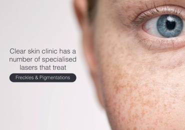 best laser treatment clinic in india