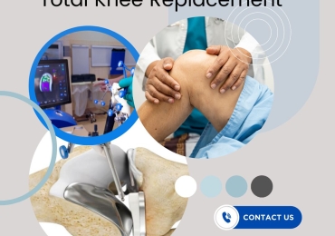 What are the long-term effects of total knee replacement?