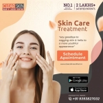 Laser Treatment For Birthmark Removal In India