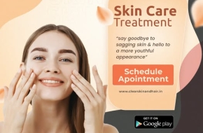 Laser Treatment For Birthmark Removal In India