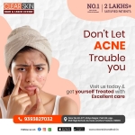 facial port wine stain Treatment in india
