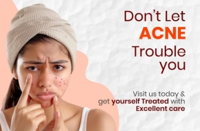 facial port wine stain Treatment in india